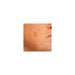cryoiq_derm_plus_cryotherapy_kit_zone_medical_brown_spot_removal_treatment_300x300.jpg