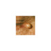 cryoiq_derm_plus_cryotherapy_kit_zone_medical_sebaceous_cyst_removal_treatment_300x300.jpg